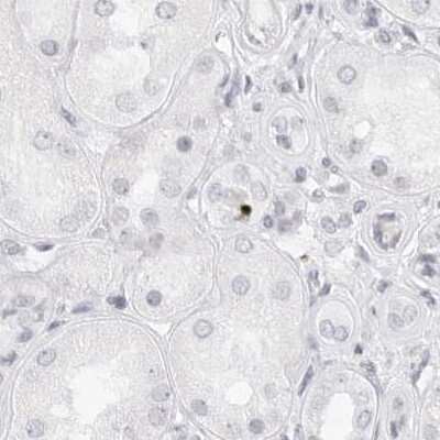 Immunohistochemistry-Paraffin: MYBPC1 Antibody [NBP1-86385]