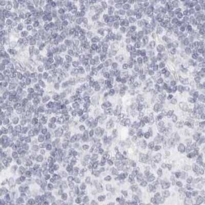 Immunohistochemistry-Paraffin: MYBPC1 Antibody [NBP1-86385]