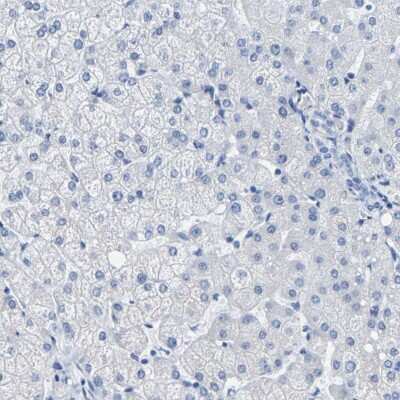 Immunohistochemistry-Paraffin: MYBPC1 Antibody [NBP1-86427]