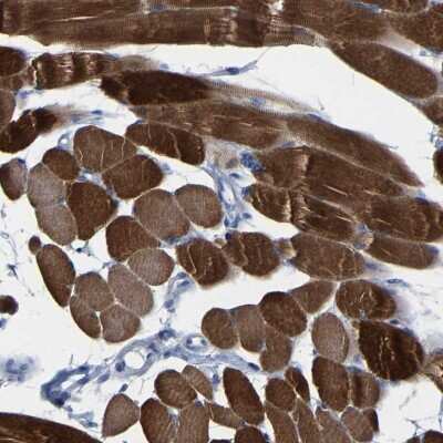 Immunohistochemistry-Paraffin: MYBPC1 Antibody [NBP1-86427]