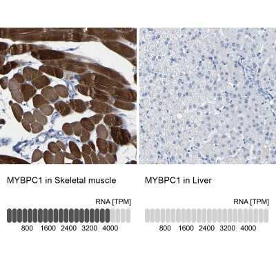 Immunohistochemistry-Paraffin: MYBPC1 Antibody [NBP1-86427]