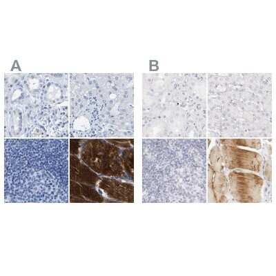 Immunohistochemistry-Paraffin: MYBPC1 Antibody [NBP1-86427]