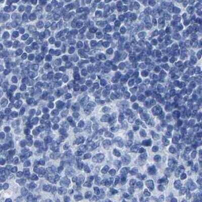 Immunohistochemistry-Paraffin: MYBPC1 Antibody [NBP1-86427]