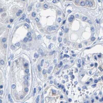 Immunohistochemistry-Paraffin: MYBPC1 Antibody [NBP1-86427]