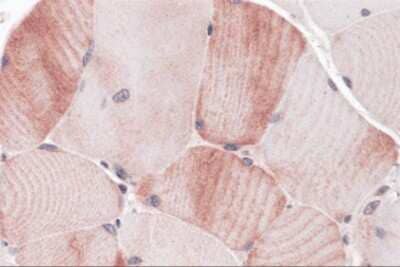 Immunohistochemistry-Paraffin: MYBPC1 Antibody - BSA Free [NBP2-41119]