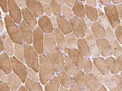 Immunohistochemistry-Paraffin: MYBPC1 Antibody [NBP2-98527]