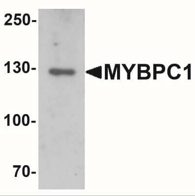 Western Blot: MYBPC1 AntibodyBSA Free [NBP2-41157]