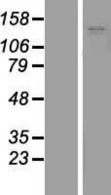 Western Blot: MYBPC1 Overexpression Lysate [NBP2-04537]