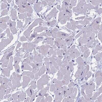 Immunohistochemistry-Paraffin: MYBPC2 Antibody [NBP2-48779]