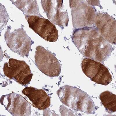 Immunohistochemistry-Paraffin: MYBPC2 Antibody [NBP2-48779]