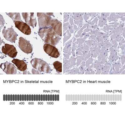 Immunohistochemistry-Paraffin: MYBPC2 Antibody [NBP2-48779]