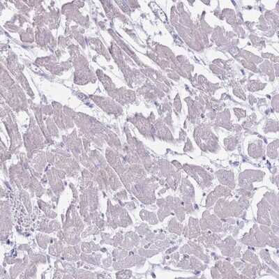Immunohistochemistry-Paraffin: MYBPC2 Antibody [NBP2-48857]