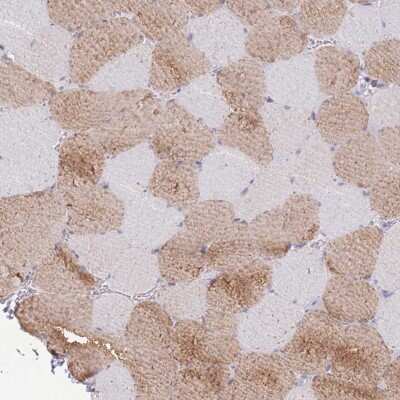 Immunohistochemistry-Paraffin: MYBPC2 Antibody [NBP2-48857]