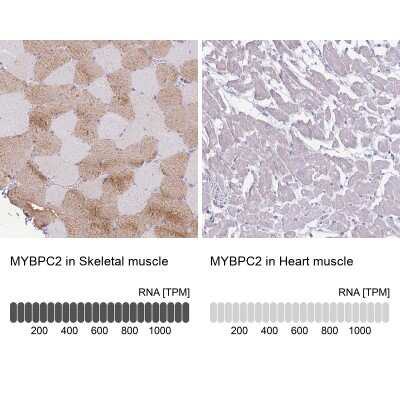 Immunohistochemistry-Paraffin: MYBPC2 Antibody [NBP2-48857]