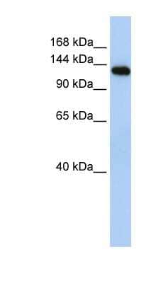 Western Blot: MYBPC2 Antibody [NBP1-70646]