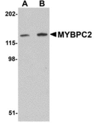 Western Blot: MYBPC2 AntibodyBSA Free [NBP1-77133]