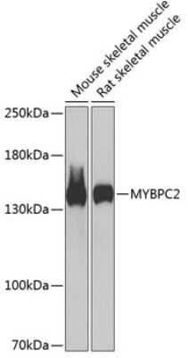 Western Blot: MYBPC2 AntibodyBSA Free [NBP2-93972]