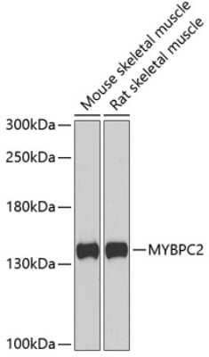 Western Blot: MYBPC2 AntibodyBSA Free [NBP2-95222]