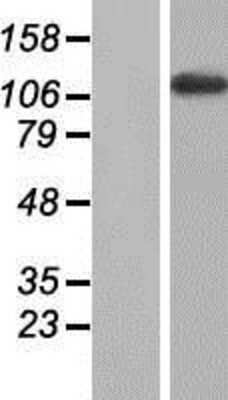 Western Blot: MYBPC2 Overexpression Lysate [NBP2-07862]