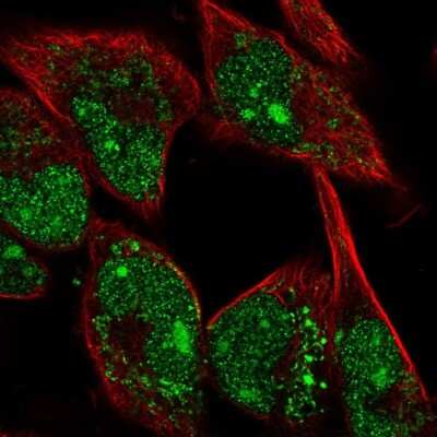 Immunocytochemistry/ Immunofluorescence: MYBPH Antibody [NBP2-57149]