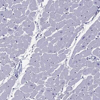 Immunohistochemistry-Paraffin: MYBPH Antibody [NBP2-57149]