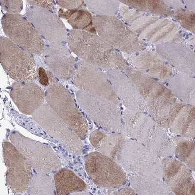 Immunohistochemistry-Paraffin: MYBPH Antibody [NBP2-57149]