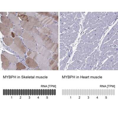 Immunohistochemistry-Paraffin: MYBPH Antibody [NBP2-57149]