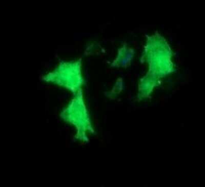 Immunocytochemistry/ Immunofluorescence: MYBPH Antibody (OTI3G1) - Azide and BSA Free [NBP2-72839]