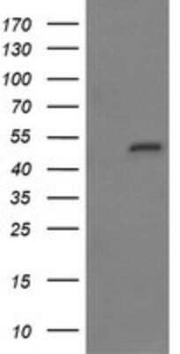 Western Blot: MYBPH Antibody (OTI3G1)Azide and BSA Free [NBP2-72839]