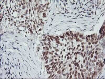 Immunohistochemistry: MYBPH Antibody (OTI3G1) [NBP2-45839]