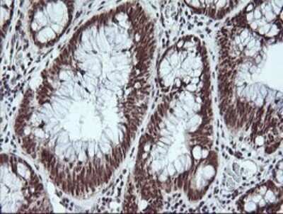Immunohistochemistry: MYBPH Antibody (OTI3G1) [NBP2-45839]