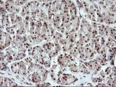 Immunohistochemistry: MYBPH Antibody (OTI3G1) [NBP2-45839]