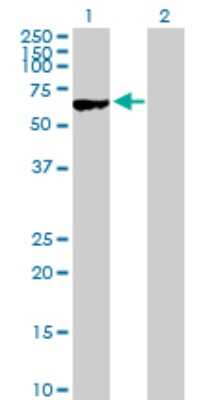 Western Blot: MYBPH Antibody [H00004608-D01P]