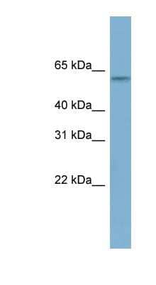 Western Blot: MYBPH Antibody [NBP1-59131]