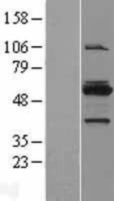 Western Blot: MYBPH Overexpression Lysate [NBL1-13413]