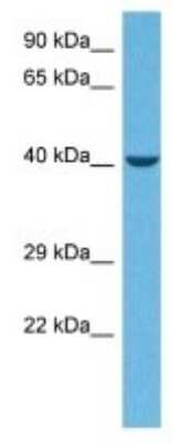 Western Blot: MYBPHL Antibody [NBP3-10161]