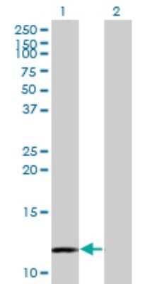 Western Blot: MYCBP Antibody (1F10) [H00026292-M08]