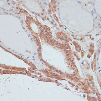 Immunohistochemistry-Paraffin: MYCBP Antibody - Azide and BSA Free [NBP2-93175]