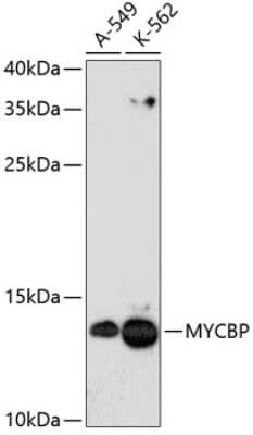 Western Blot: MYCBP AntibodyAzide and BSA Free [NBP2-93175]