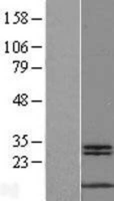 Western Blot: MYCBP Overexpression Lysate [NBL1-13415]