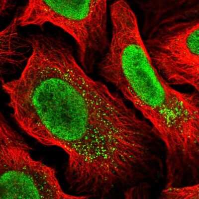 Immunocytochemistry/ Immunofluorescence: MYCBP2 Antibody [NBP2-68745]