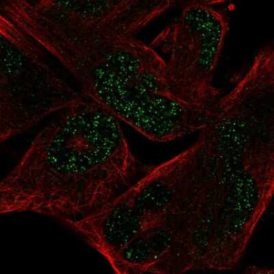 Immunocytochemistry/ Immunofluorescence: MYCL1/L-Myc Antibody [NBP2-55735]