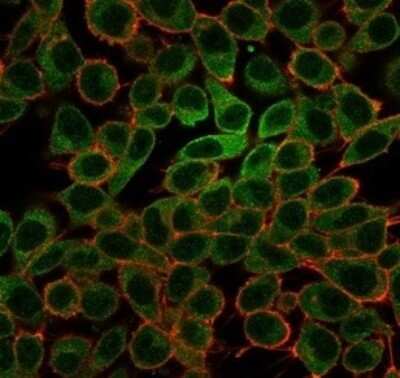 Immunocytochemistry/ Immunofluorescence: MYCL1/L-Myc Antibody (PCRP-MYCL-2D5) [NBP3-13977]