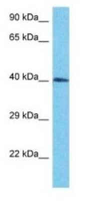 Western Blot: MYCL2 Antibody [NBP3-09212]