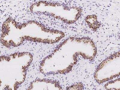 Immunohistochemistry-Paraffin: MYCT1 Antibody [NBP3-06219]