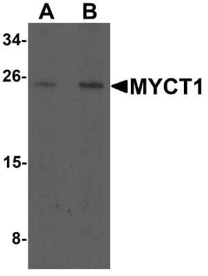 Western Blot: MYCT1 AntibodyBSA Free [NBP2-81921]