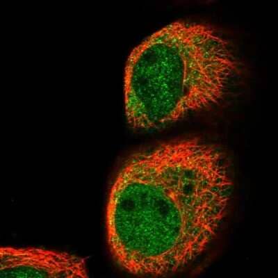 Immunocytochemistry/ Immunofluorescence: MYD118 Antibody [NBP1-87990]