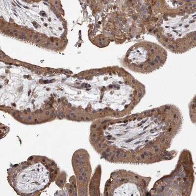 Immunohistochemistry-Paraffin: MYD118 Antibody [NBP1-87990]