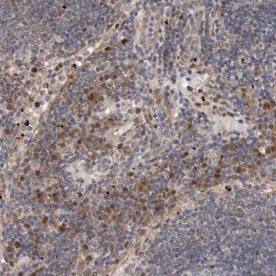Immunohistochemistry-Paraffin: MYD118 Antibody [NBP1-87990]