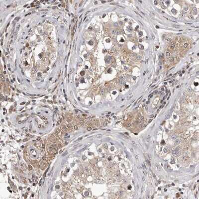Immunohistochemistry-Paraffin: MYD118 Antibody [NBP1-87990]